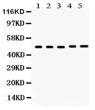 Vitamin D Receptor/VDR Rabbit Polyclonal Antibody