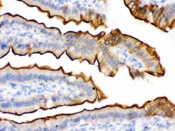 Villin/VIL1 Rabbit Polyclonal Antibody