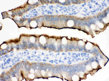 Villin/VIL1 Rabbit Polyclonal Antibody