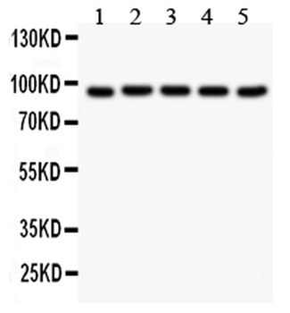 Villin/VIL1 Rabbit Polyclonal Antibody