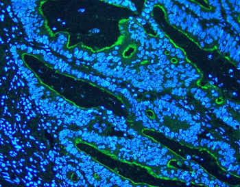 Villin/VIL1 Rabbit Polyclonal Antibody