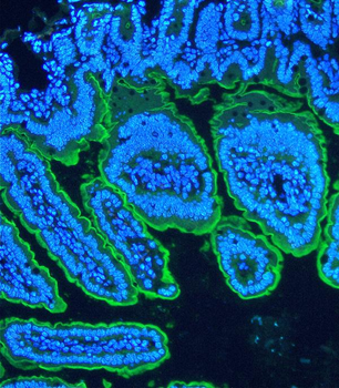 Villin/VIL1 Rabbit Polyclonal Antibody