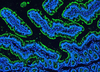 Villin/VIL1 Rabbit Polyclonal Antibody