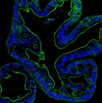 Villin/VIL1 Rabbit Polyclonal Antibody