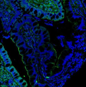 Villin/VIL1 Rabbit Polyclonal Antibody