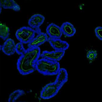 Villin/VIL1 Rabbit Polyclonal Antibody