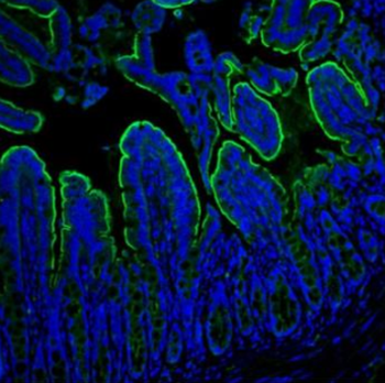 Villin/VIL1 Rabbit Polyclonal Antibody