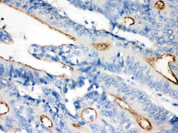 Villin/VIL1 Rabbit Polyclonal Antibody