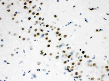 Wnt2b Rabbit Polyclonal Antibody