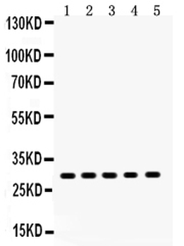 XBP1 Rabbit Polyclonal Antibody