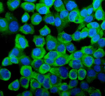 YB1/YBX1 Rabbit Polyclonal Antibody