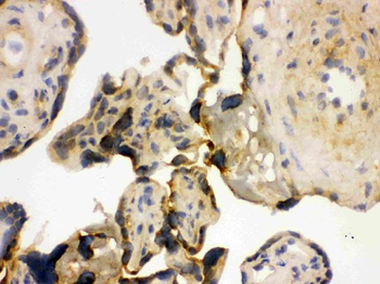 YB1/YBX1 Rabbit Polyclonal Antibody