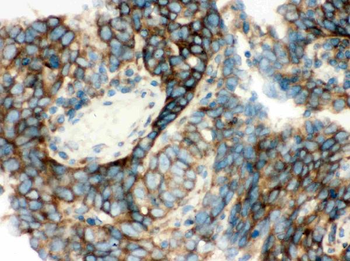 YB1/YBX1 Rabbit Polyclonal Antibody
