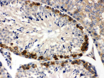 YB1/YBX1 Rabbit Polyclonal Antibody