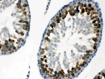 YB1/YBX1 Rabbit Polyclonal Antibody