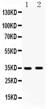 HSD17B6 Rabbit Polyclonal Antibody