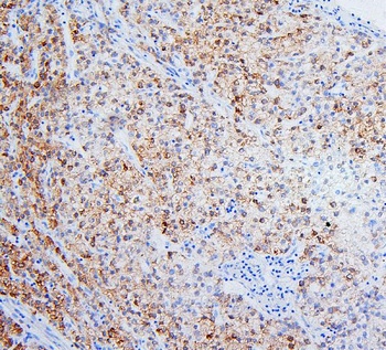 HSD17B6 Rabbit Polyclonal Antibody