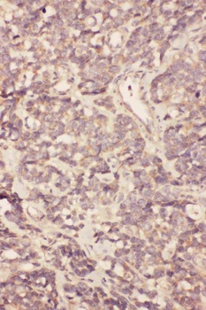 Fibroblast growth factor 19 FGF19 Rabbit Polyclonal Antibody
