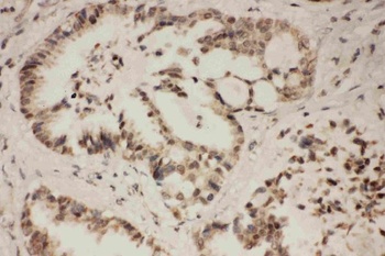 FGFR1 Rabbit Polyclonal Antibody
