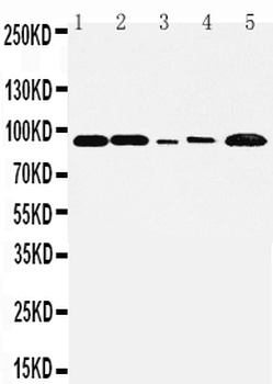 FGFR1 Rabbit Polyclonal Antibody