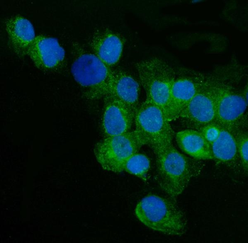 CD59 glycoprotein CD59 Rabbit Polyclonal Antibody