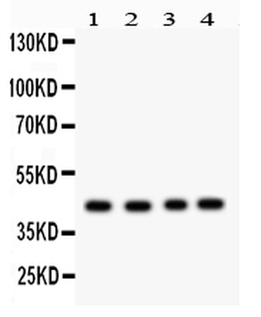 TSG101 Rabbit Polyclonal Antibody