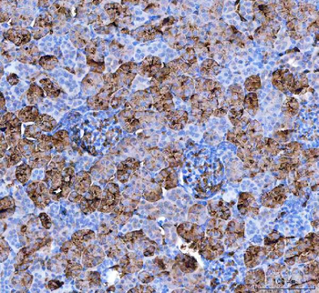 Aquaporin 1/AQP1 Rabbit Polyclonal Antibody