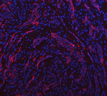 Aquaporin 1/AQP1 Rabbit Polyclonal Antibody