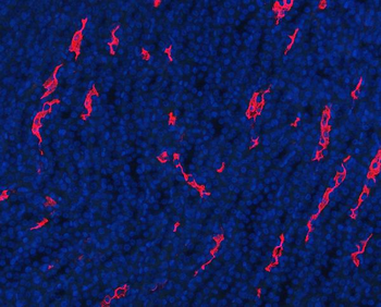 Aquaporin 1/AQP1 Rabbit Polyclonal Antibody