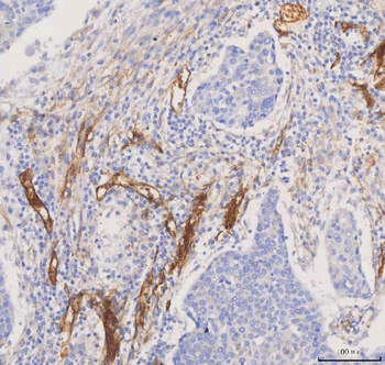 Aquaporin 1/AQP1 Rabbit Polyclonal Antibody