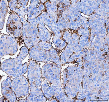 Aquaporin 1/AQP1 Rabbit Polyclonal Antibody