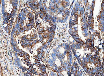Aquaporin 1/AQP1 Rabbit Polyclonal Antibody