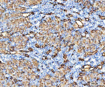 Aquaporin 1/AQP1 Rabbit Polyclonal Antibody