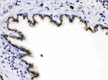 ARSA Rabbit Polyclonal Antibody