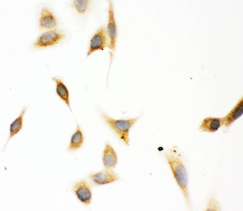 Aspartate beta hydroxylase/ASPH Rabbit Polyclonal Antibody