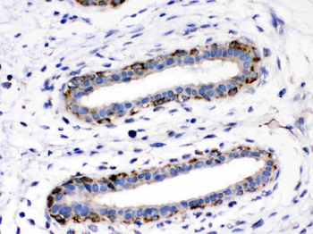Aspartate beta hydroxylase/ASPH Rabbit Polyclonal Antibody