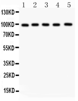 Aspartate beta hydroxylase/ASPH Rabbit Polyclonal Antibody