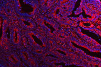 ATG14L Rabbit Polyclonal Antibody