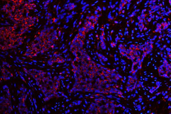 ATG14L Rabbit Polyclonal Antibody