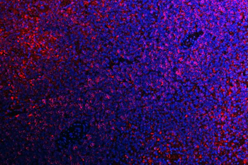 ATG14L Rabbit Polyclonal Antibody
