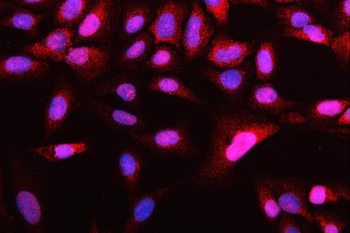 ATG14L Rabbit Polyclonal Antibody