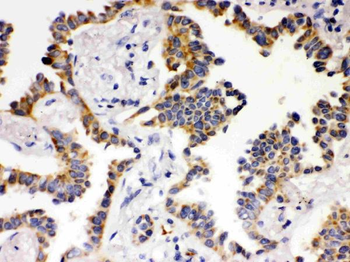 ATG14L Rabbit Polyclonal Antibody