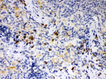 ATG14L Rabbit Polyclonal Antibody