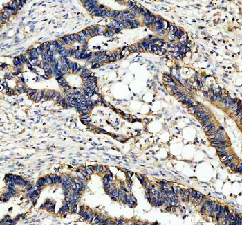alpha 1 Sodium Potassium ATPase/ATP1A1 Rabbit Polyclonal Antibody