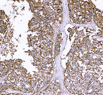 alpha 1 Sodium Potassium ATPase/ATP1A1 Rabbit Polyclonal Antibody