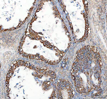 alpha 1 Sodium Potassium ATPase/ATP1A1 Rabbit Polyclonal Antibody