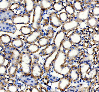 alpha 1 Sodium Potassium ATPase/ATP1A1 Rabbit Polyclonal Antibody