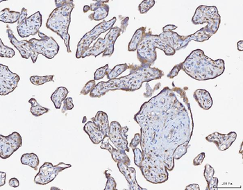 ATX2/ATXN2 Rabbit Polyclonal Antibody