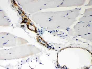 BAK/BAK1 Rabbit Polyclonal Antibody