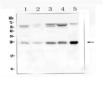 BAK/BAK1 Rabbit Polyclonal Antibody